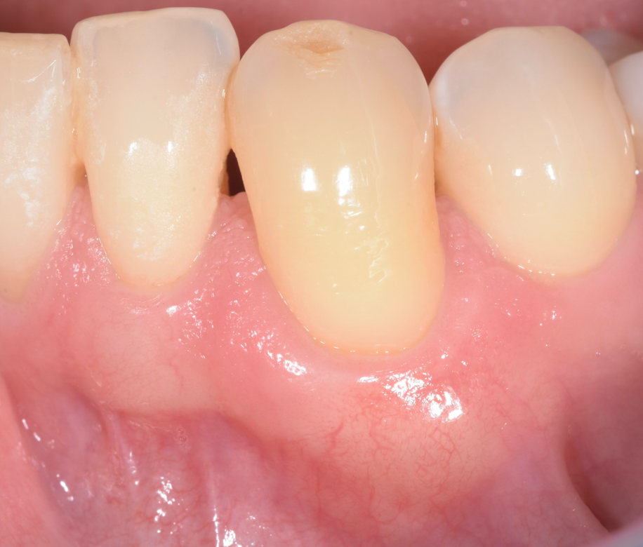 Case study after treatment
